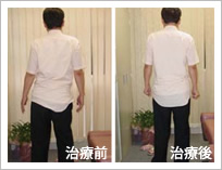 治療前治療後 治療前治療後